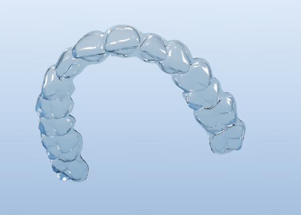 A clear-aligner tray designed in NexusAligner, rendered from the case.